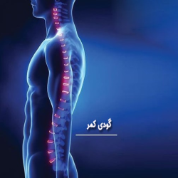 بهترین تشک برای گودی کمر